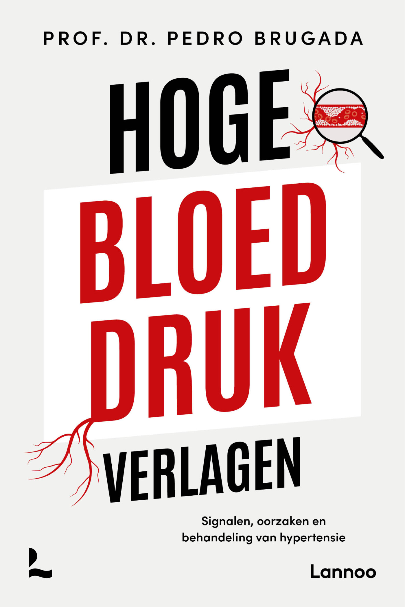 Hoge bloeddruk verlagen Hoge bloeddruk verlagen